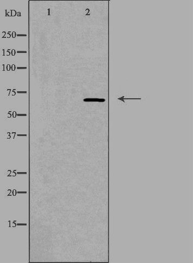 NEIL3 Antibody in Western Blot (WB)