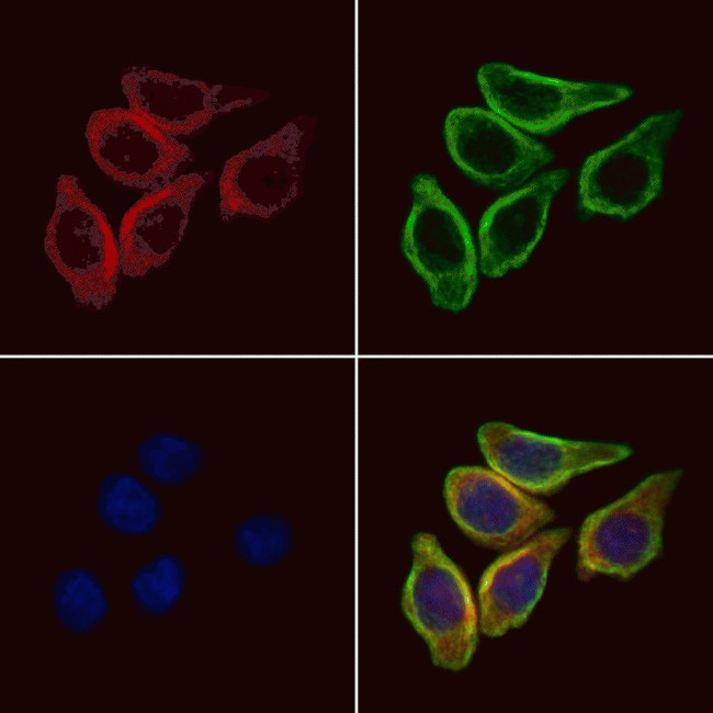 Epsin 3 Antibody in Immunocytochemistry (ICC/IF)