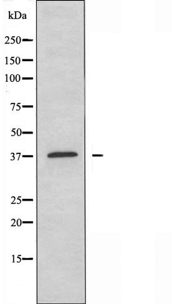 eIF3f Antibody in Western Blot (WB)