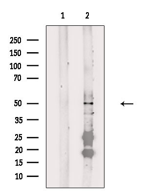 FOXD4L1 Antibody in Western Blot (WB)