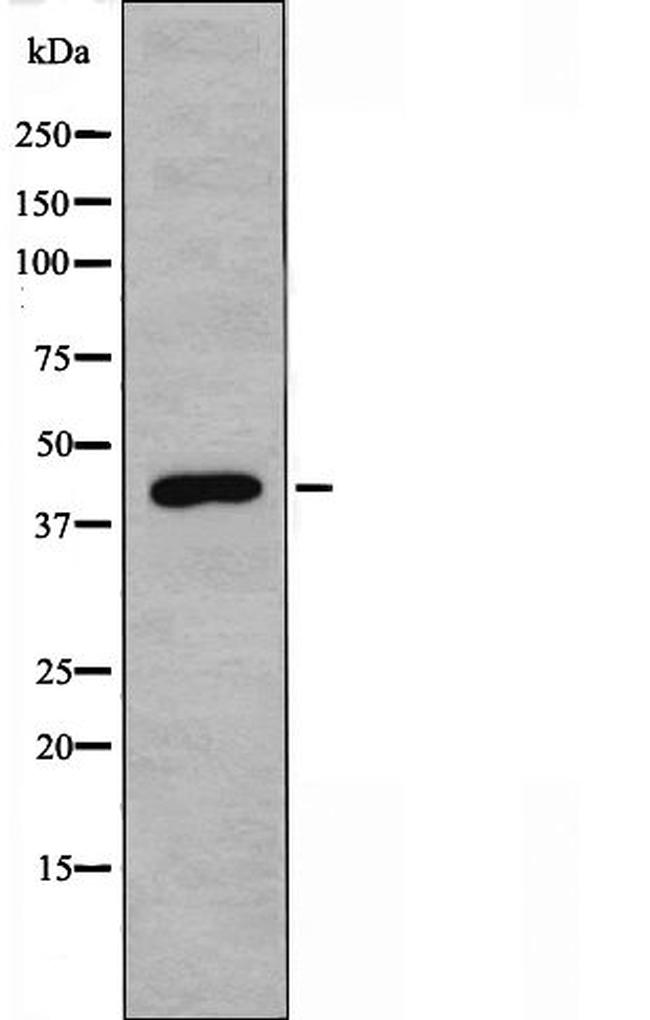 FOXD4/L2/L3/L4/L5/L6 Antibody in Western Blot (WB)
