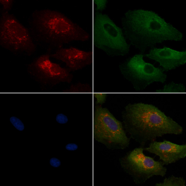 GNAI3 Antibody in Immunocytochemistry (ICC/IF)