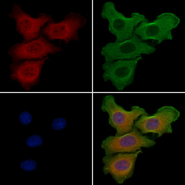 GBP3 Antibody in Immunocytochemistry (ICC/IF)