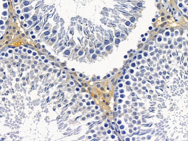 HLA-H Antibody in Immunohistochemistry (Paraffin) (IHC (P))