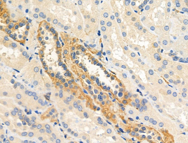HLA-DPA1 Antibody in Immunohistochemistry (Paraffin) (IHC (P))
