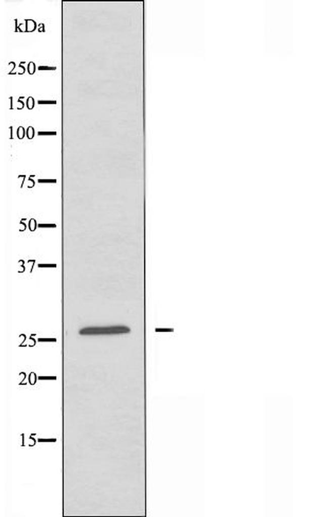 HOXA6 Antibody in Western Blot (WB)