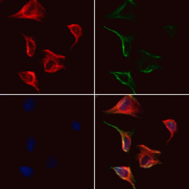 GSDMC Antibody in Immunocytochemistry (ICC/IF)