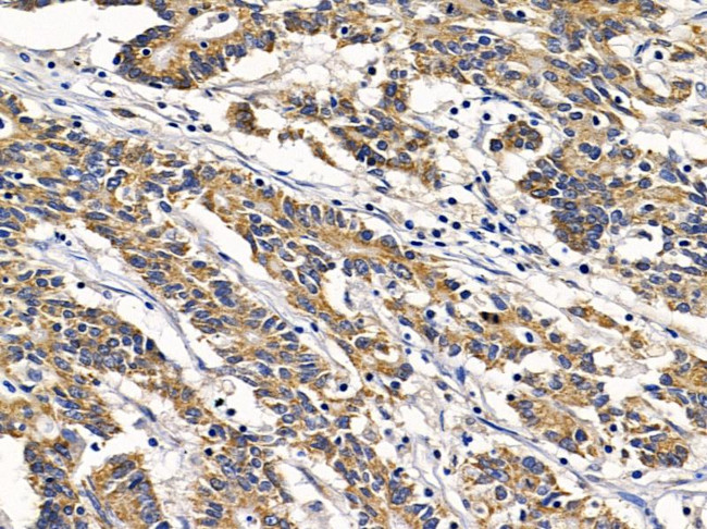 CLNS1A Antibody in Immunohistochemistry (Paraffin) (IHC (P))