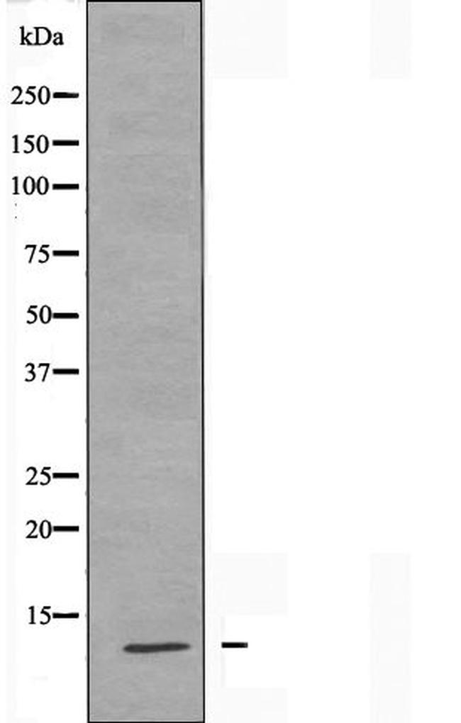 MRPS21 Antibody in Western Blot (WB)