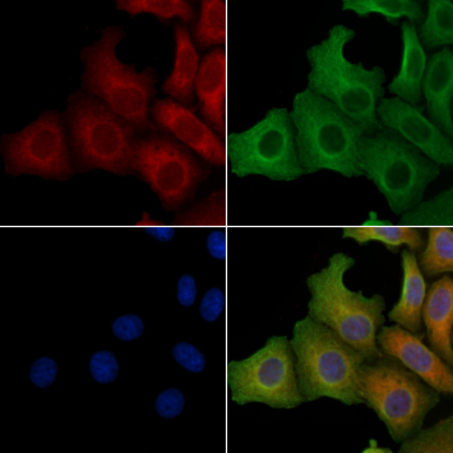 SLC25A11 Antibody in Immunocytochemistry (ICC/IF)