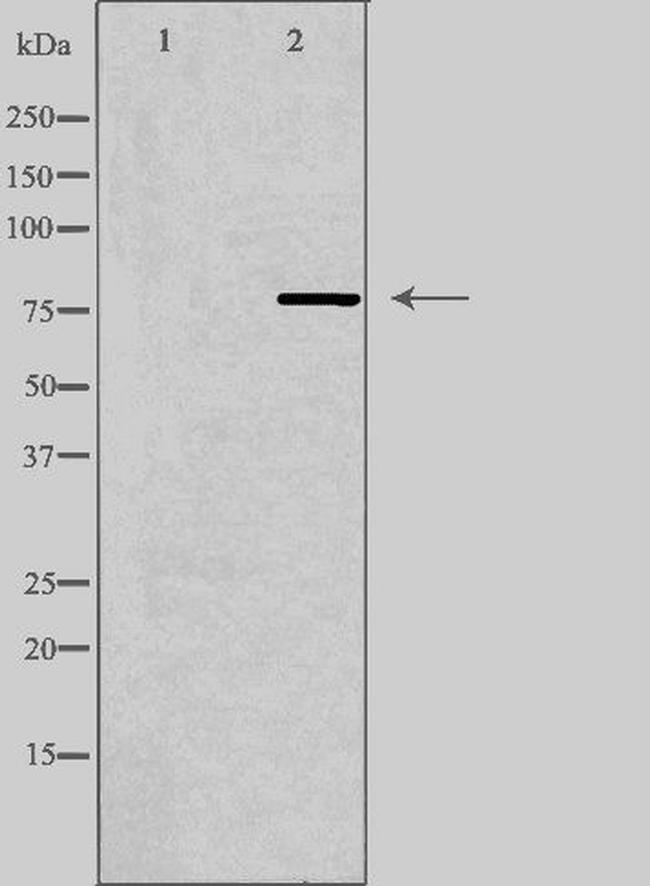 MPP9 Antibody in Western Blot (WB)