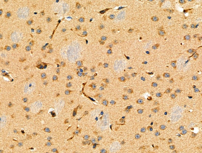 MYOM2 Antibody in Immunohistochemistry (Paraffin) (IHC (P))