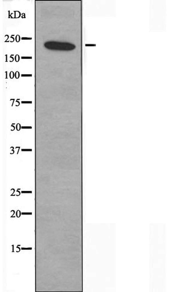 MYH15 Antibody in Western Blot (WB)