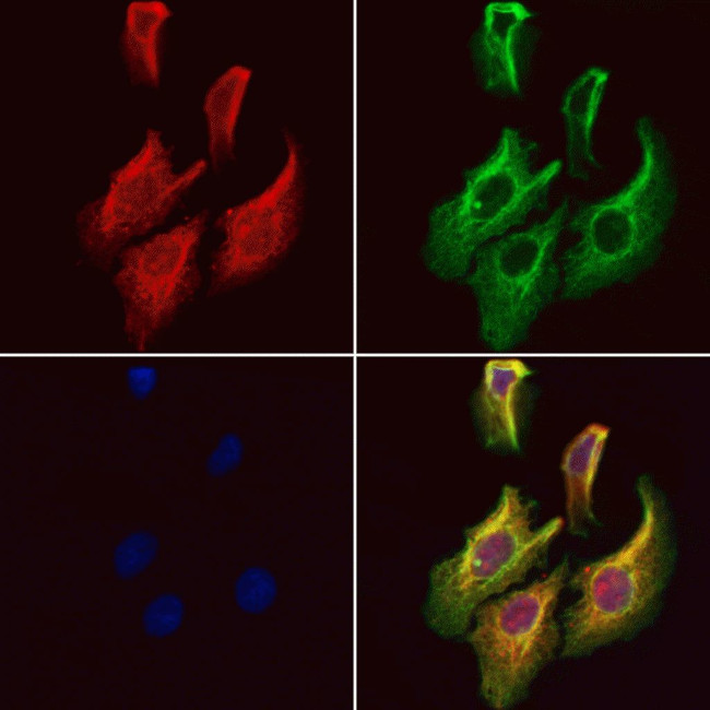 MYBPC1 Antibody in Immunocytochemistry (ICC/IF)