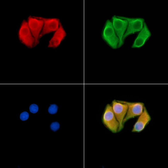 MYO5A Antibody in Immunocytochemistry (ICC/IF)
