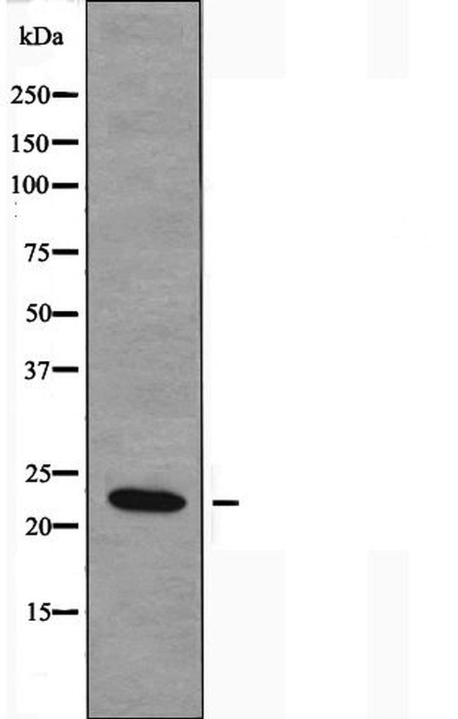 NDUFB9 Antibody in Western Blot (WB)