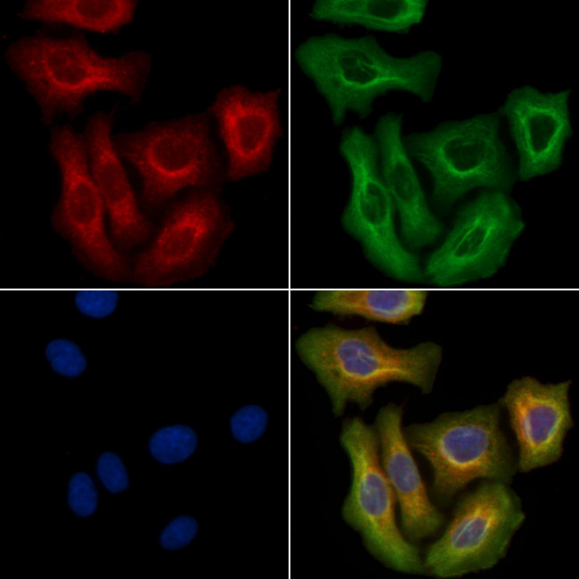 MT-ND5 Antibody in Immunocytochemistry (ICC/IF)