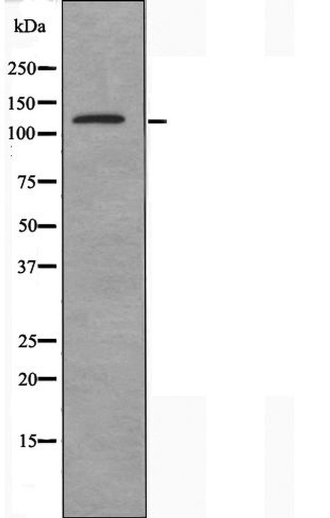 SYNE3 Antibody in Western Blot (WB)