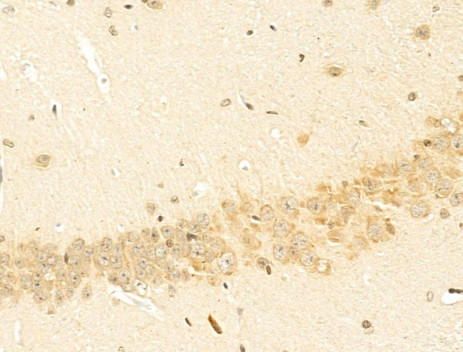 NBPF Pan Antibody in Immunohistochemistry (Paraffin) (IHC (P))