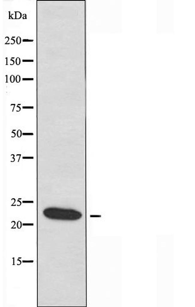 NMS Antibody in Western Blot (WB)