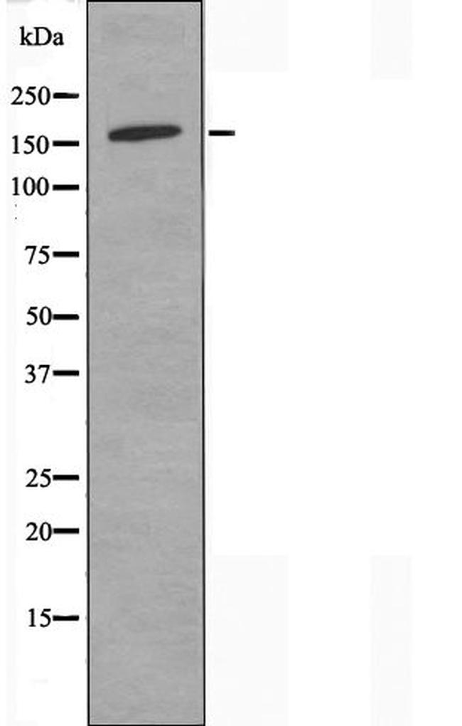 NTE Antibody in Western Blot (WB)