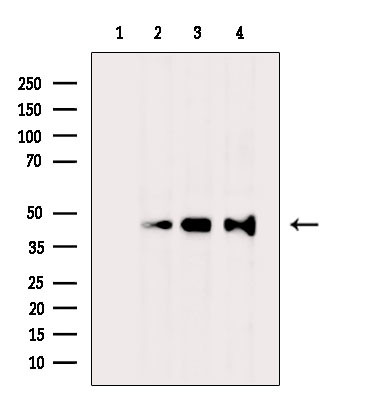 NTM Antibody in Western Blot (WB)