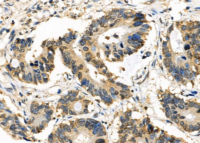 NRBF2 Antibody in Immunohistochemistry (Paraffin) (IHC (P))
