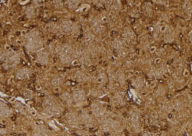 NUTF2 Antibody in Immunohistochemistry (Paraffin) (IHC (P))