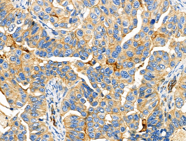 PEX10 Antibody in Immunohistochemistry (Paraffin) (IHC (P))