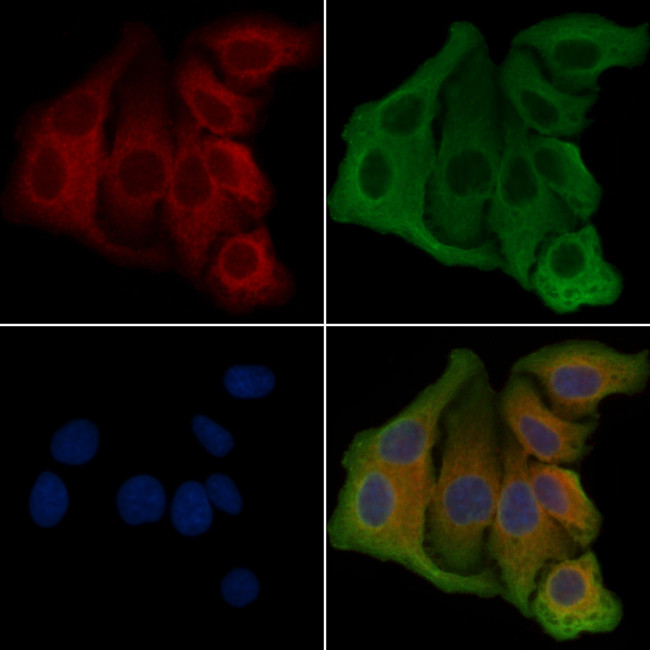 PKP4 Antibody in Immunocytochemistry (ICC/IF)