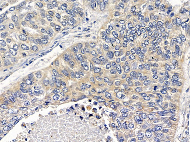 Nectin 4 Antibody in Immunohistochemistry (Paraffin) (IHC (P))