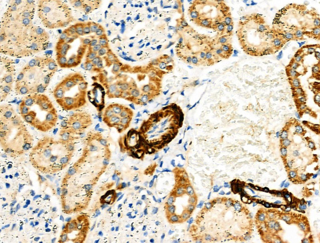 KCNK15 Antibody in Immunohistochemistry (Paraffin) (IHC (P))