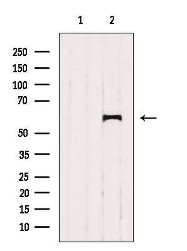 KV3.1 (KCNC1) Antibody in Western Blot (WB)