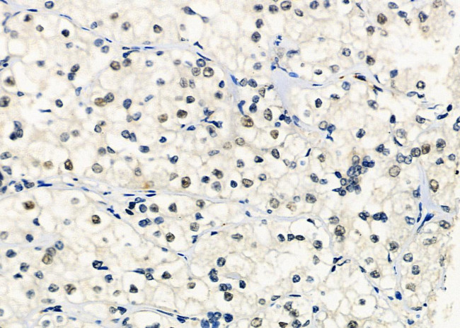 SF3B14 Antibody in Immunohistochemistry (Paraffin) (IHC (P))