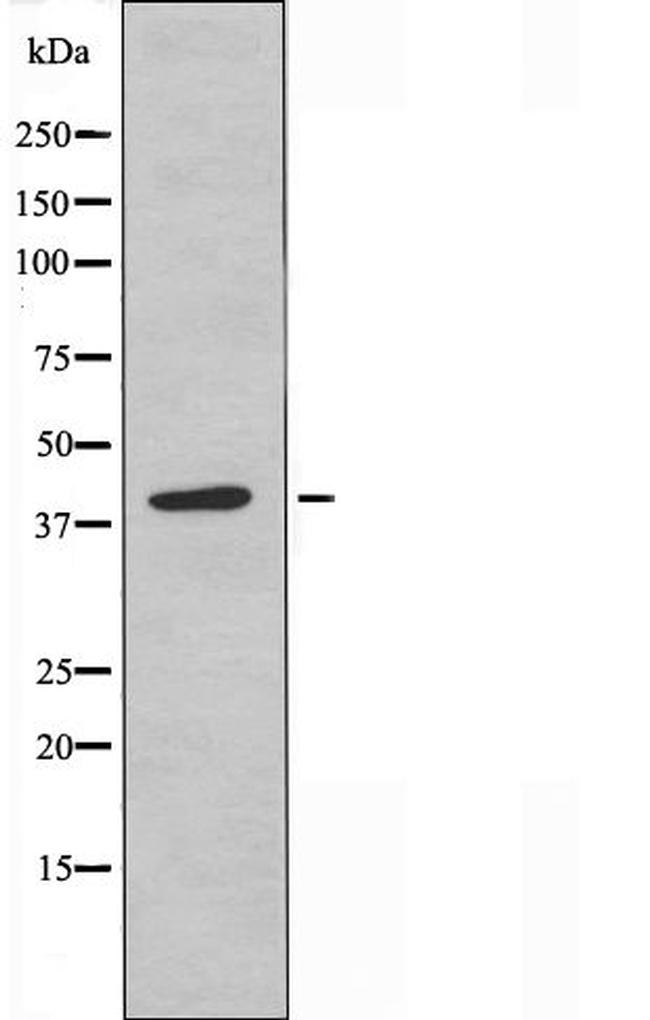 PR38A Antibody in Western Blot (WB)