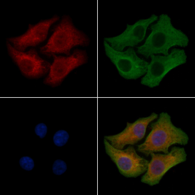 ZDHHC20 Antibody in Immunocytochemistry (ICC/IF)