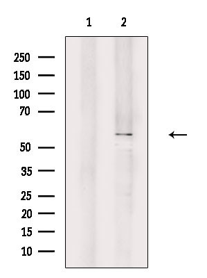 POTEB Antibody in Western Blot (WB)