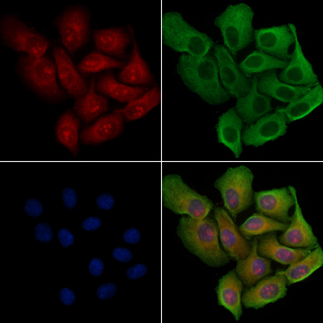 PPP1R14D Antibody in Immunocytochemistry (ICC/IF)