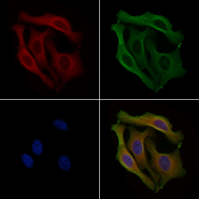 PPP1R3A Antibody in Immunocytochemistry (ICC/IF)