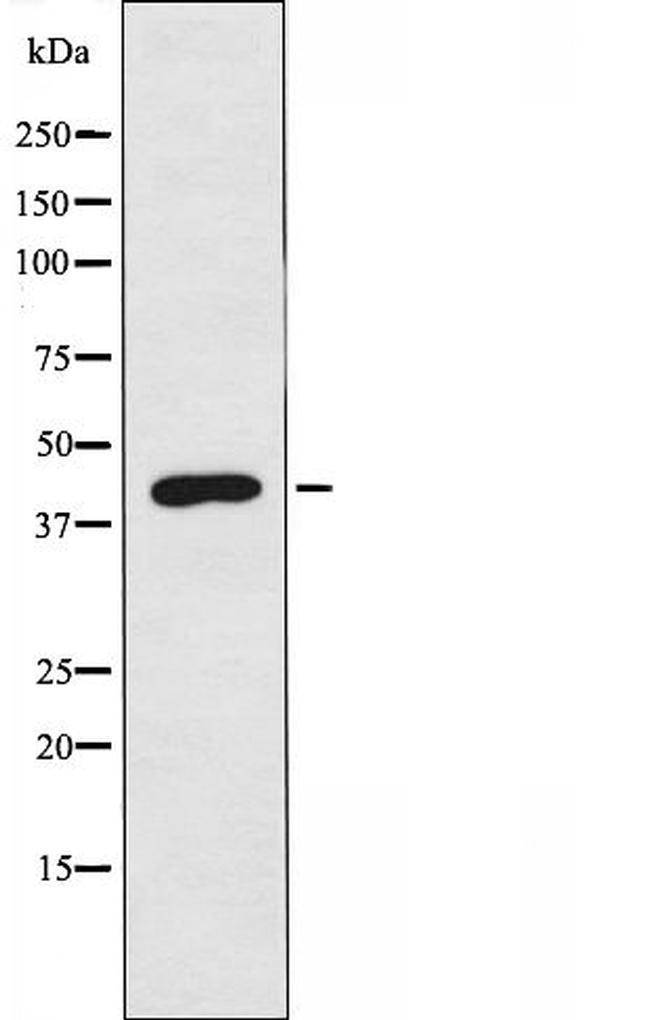 PPM1K Antibody in Western Blot (WB)