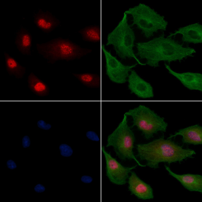 RED Antibody in Immunocytochemistry (ICC/IF)
