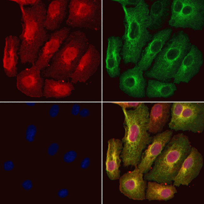 S100A16 Antibody in Immunocytochemistry (ICC/IF)