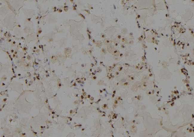 MRP13 Antibody in Immunohistochemistry (Paraffin) (IHC (P))