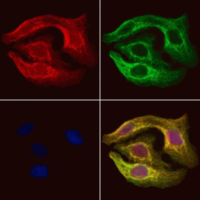 Pyruvate Carboxylase Antibody in Immunocytochemistry (ICC/IF)