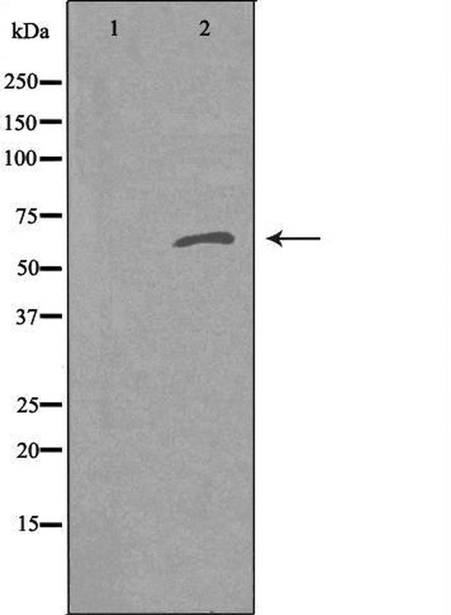 RFTN1 Antibody in Western Blot (WB)