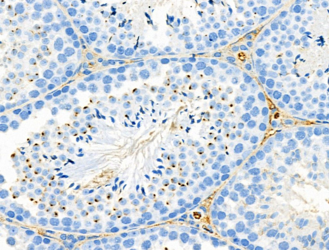 RANBP17 Antibody in Immunohistochemistry (Paraffin) (IHC (P))