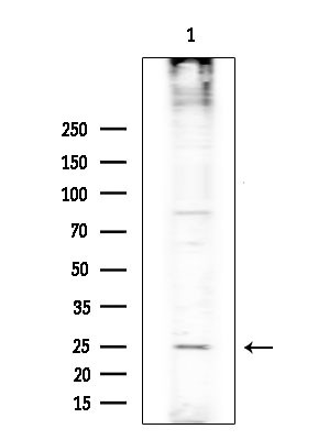 RASL10A Antibody in Western Blot (WB)