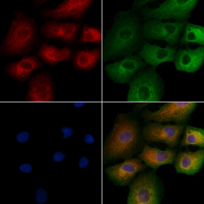 RAB2B Antibody in Immunocytochemistry (ICC/IF)