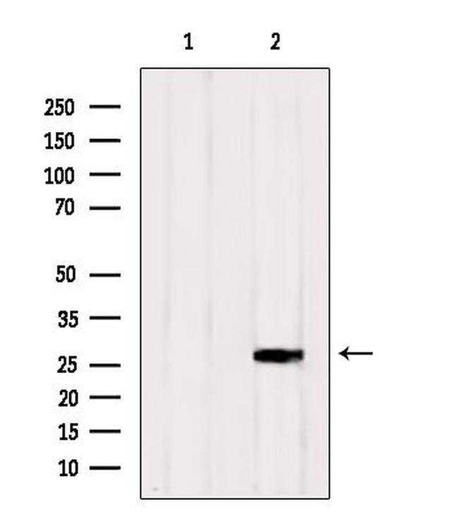 RAB33A Antibody in Western Blot (WB)