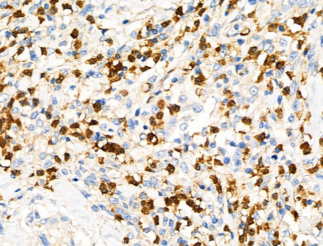 RGS1 Antibody in Immunohistochemistry (Paraffin) (IHC (P))